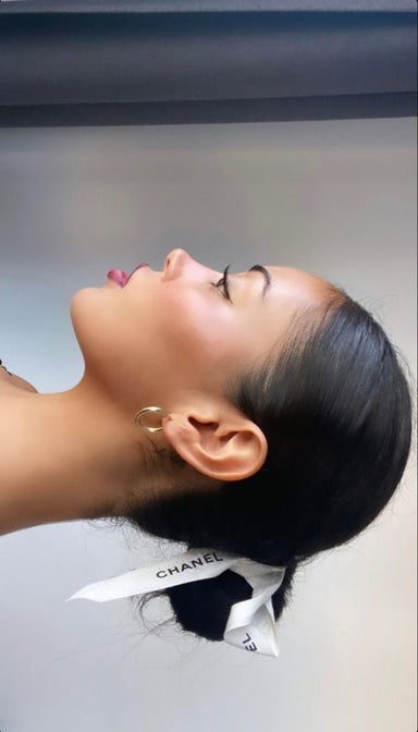 Sideburns Laser Hair Removal