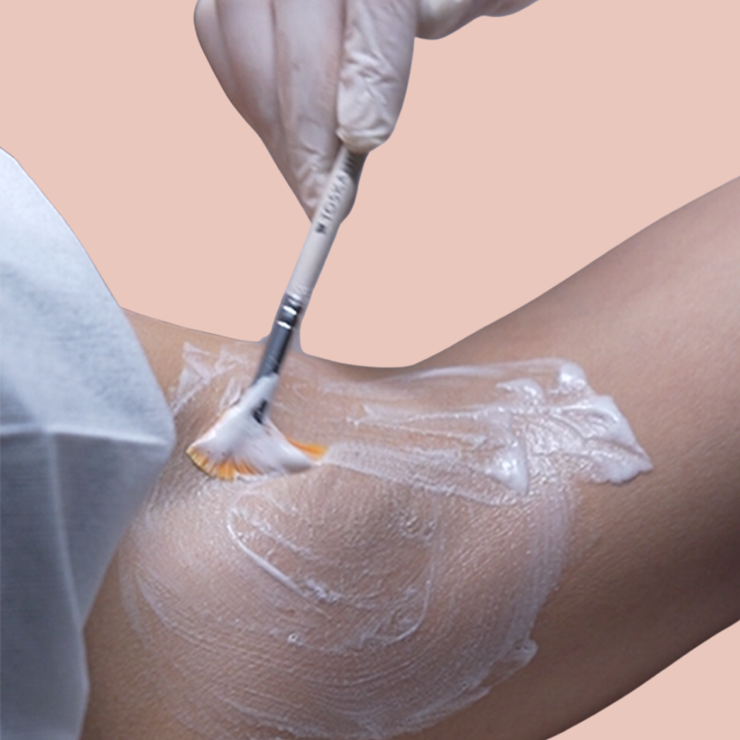 Underarm Hydrafacial